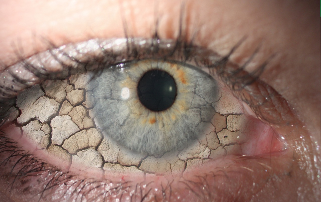 Irritação nos olhos: maior tempo de exposição às telas pode provocar uma  doença; saiba como identificar