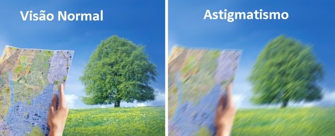 Astigmatismo